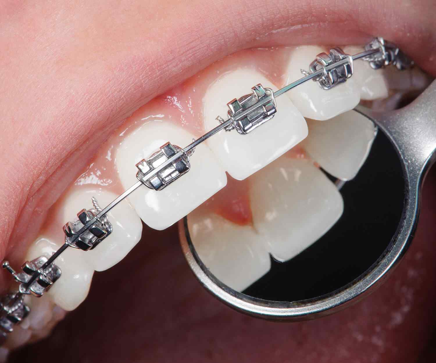 https://hexapharmaegy.com/wp-content/uploads/2021/10/card_image_home_03-03.jpg